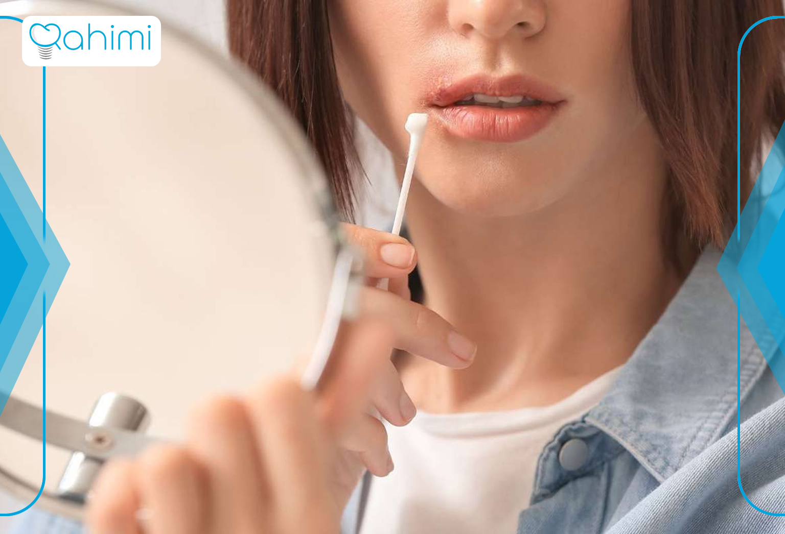 درمان‌های خانگی تبخال لثه