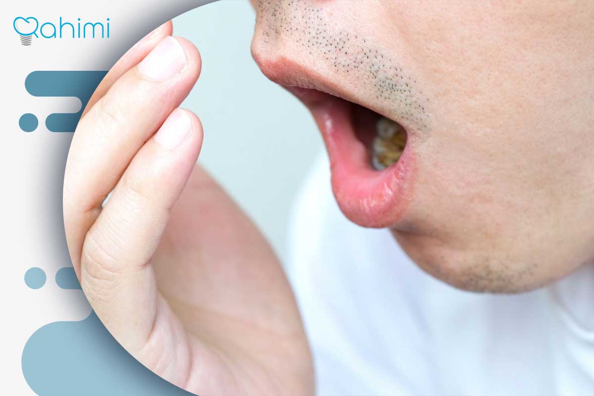 درمان خانگی هوا کشیدن دندان | راهکارهای مؤثر برای تسکین سریع درد 7 درمان پزشکی برای هوا کشیدن دندان