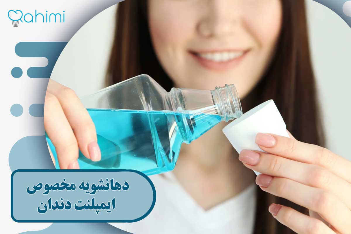دهانشویه مخصوص ایمپلنت دندان