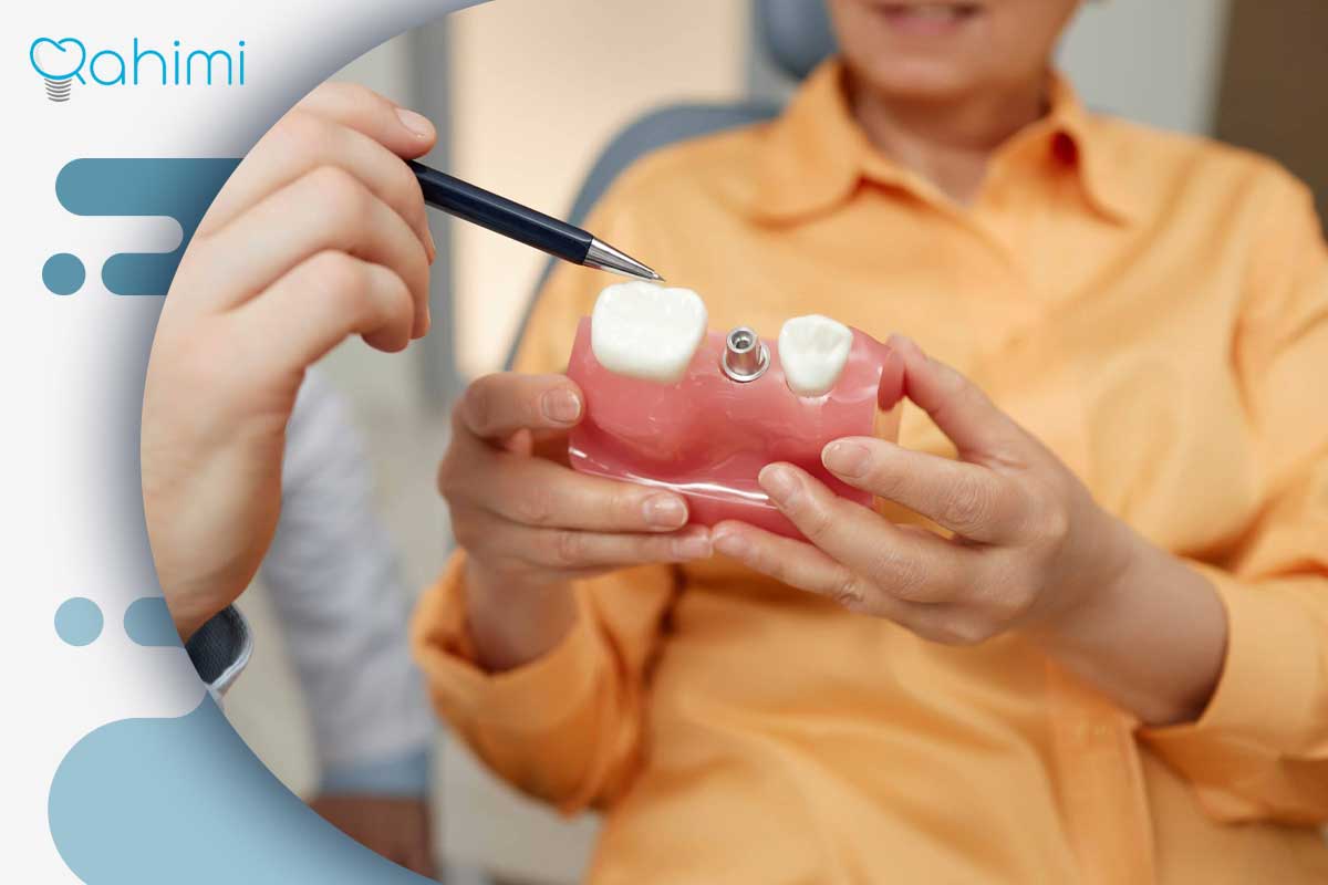 دهانشویه مخصوص ایمپلنت دندان 2 دهانشویه مناسب برای ایمپلنت