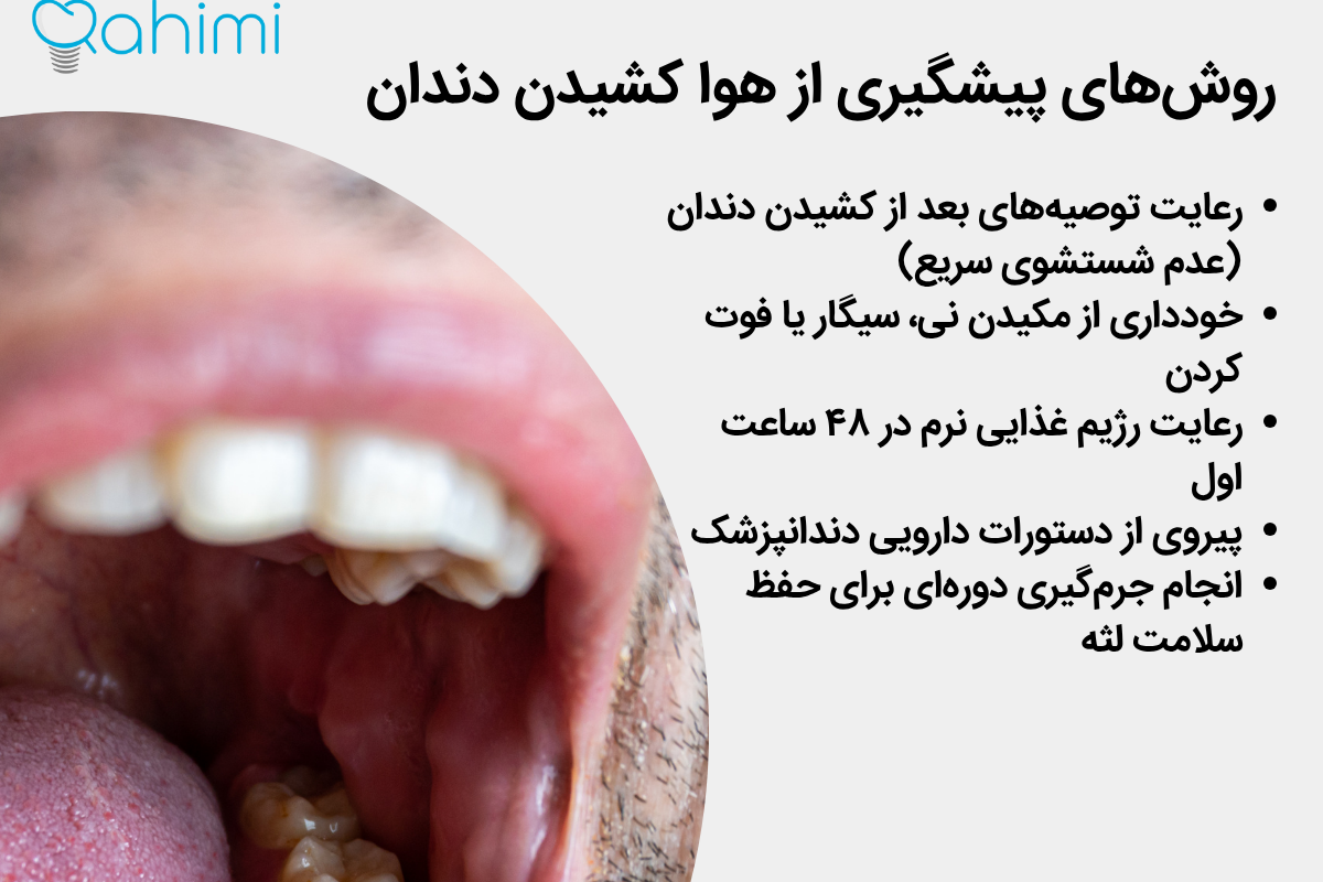 درمان خانگی هوا کشیدن دندان | راهکارهای مؤثر برای تسکین سریع درد 8 روشهای پیشگیری از هوا کشیدن دندان