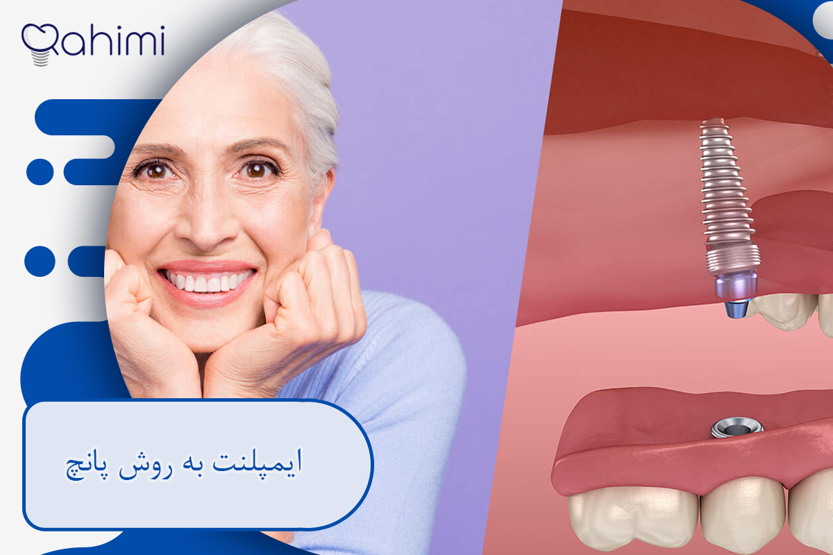 ایمپلنت به روش پانچ؛ جراحی