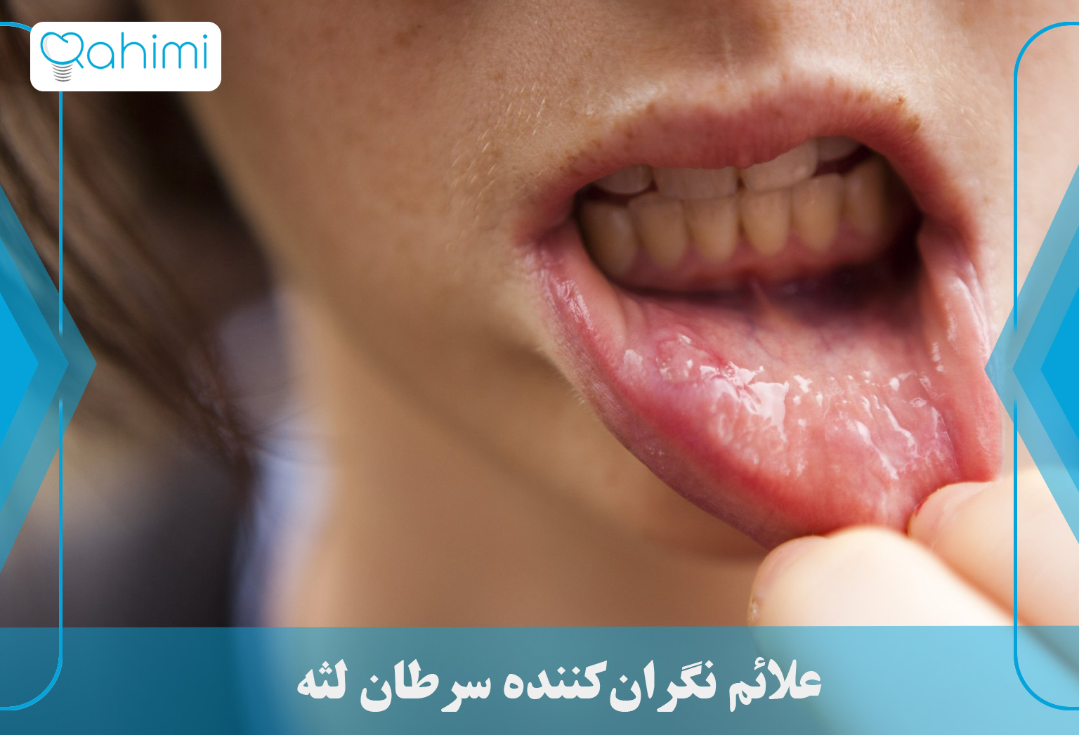 Alarming symptoms of gum cancer