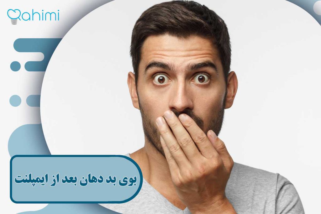 بوی بد دهان بعد از ایمپلنت