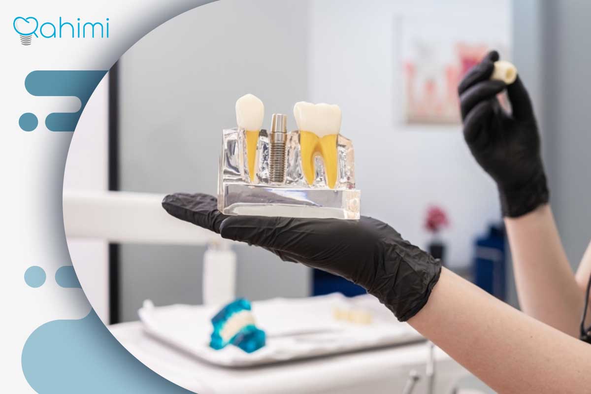 اهمیت استفاده از آب نمک بعد از جراحی ایمپلنت 3 مزایای استفاده از آب نمک بعد از ایمپلنت