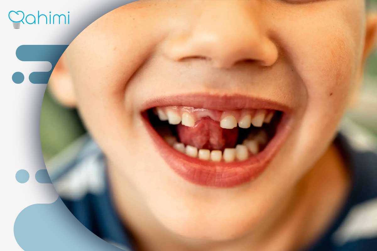 درمان فوری دندان درد شبانه کودکان 1 علت دندان درد شبانه در کودکان