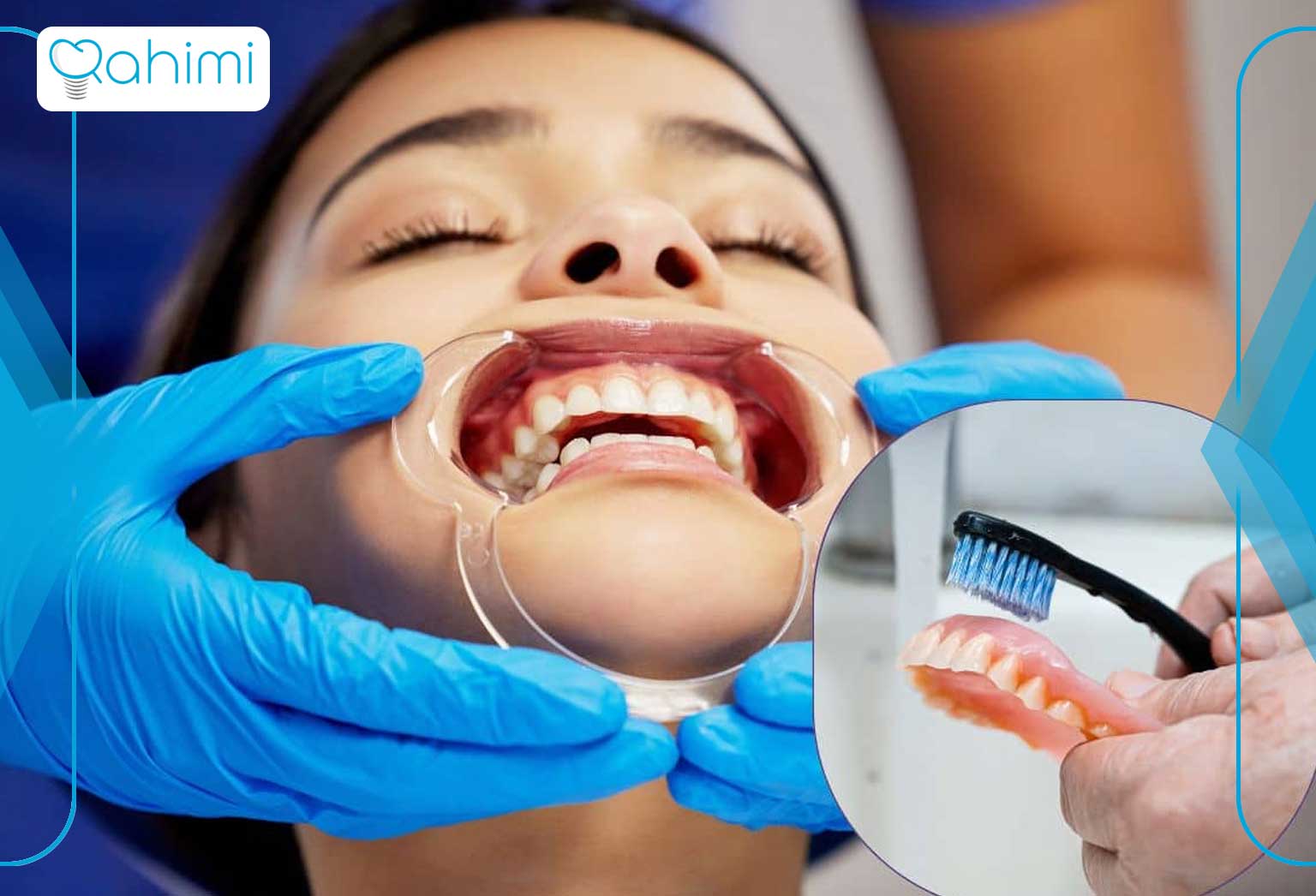 بهداشت ناکافی دهان