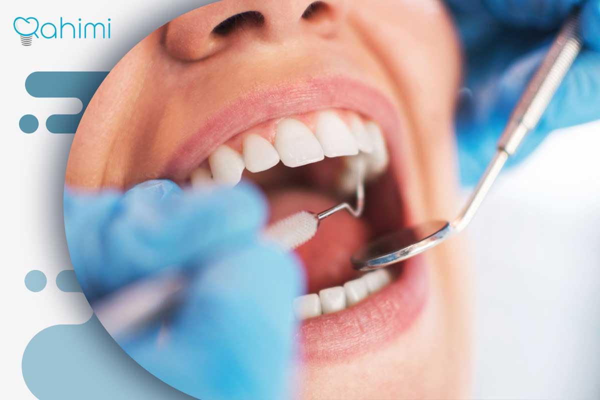 حساسیت به ایمپلنت دندان؛ علائم، علتها و روشهای کنترل واکنشهای ایمپلنت 5 روشهای تشخیص حساسیت ایمپلنت