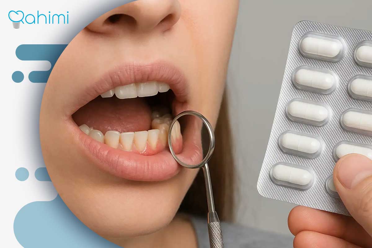 حساسیت به ایمپلنت دندان؛ علائم، علتها و روشهای کنترل واکنشهای ایمپلنت 6 روشهای درمان حساسیت به ایمپلنت دندان