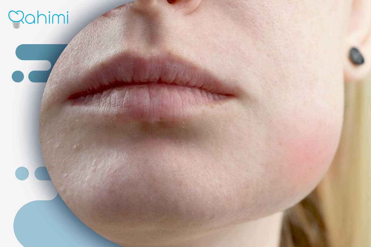 علائم و عوارض احتمالی پس از کشیدن دندان