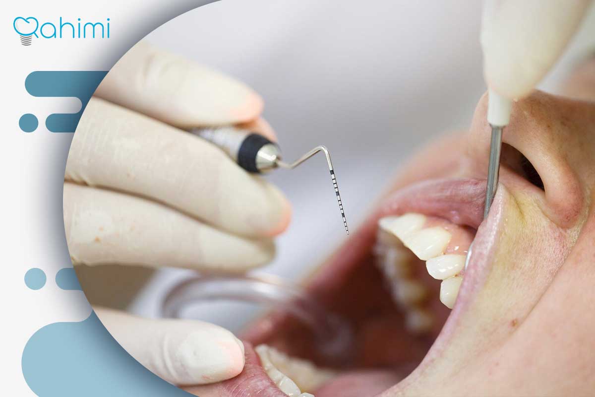 ترمیم لثه و درمان تحلیل لثه؛ علائم، علتها و روشهای جراحی و غیرجراحی 10 مراحل انجام ترمیم لثه