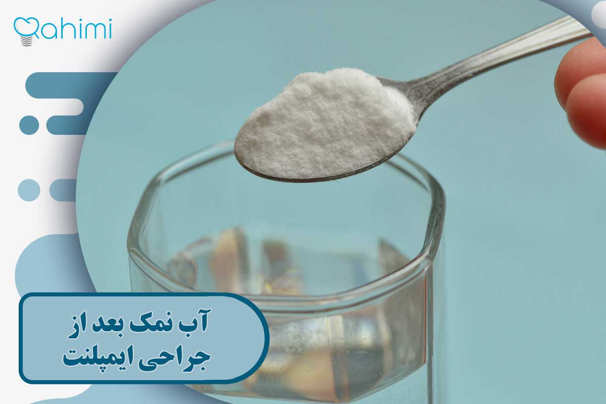 آب نمک بعد از جراحی ایمپلنت