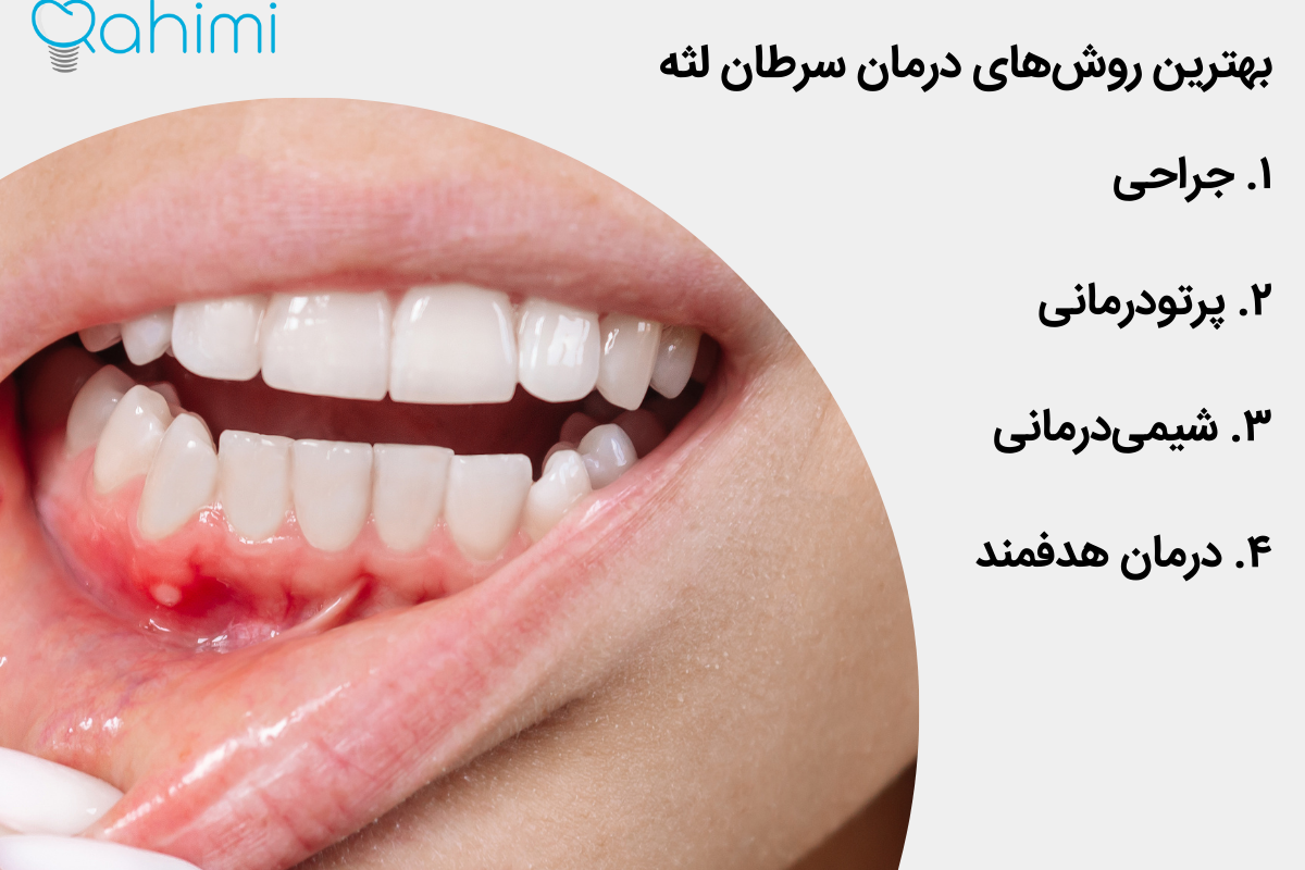 The best methods of gum cancer treatment