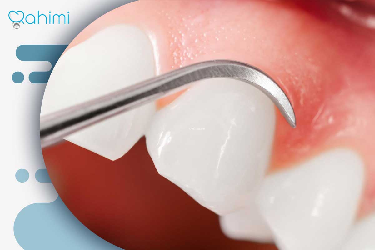 ترمیم لثه و درمان تحلیل لثه؛ علائم، علتها و روشهای جراحی و غیرجراحی 6 انواع روشهای ترمیم لثه