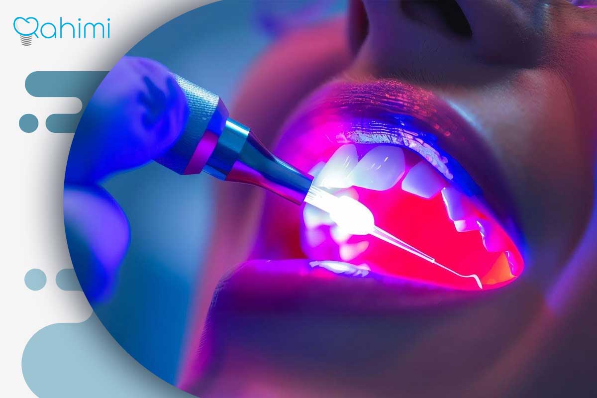 کشیدن دندان با لیزر؛ روش انجام، مزایا، کاربردها و مراقبتهای پس از درمان 3 تفاوت مراحل جراحی در دندان نهفته، پوسیده یا شکسته