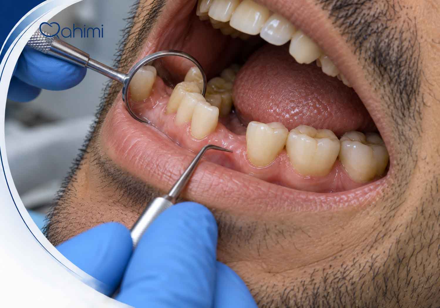 Who are generally not suitable candidates for implants