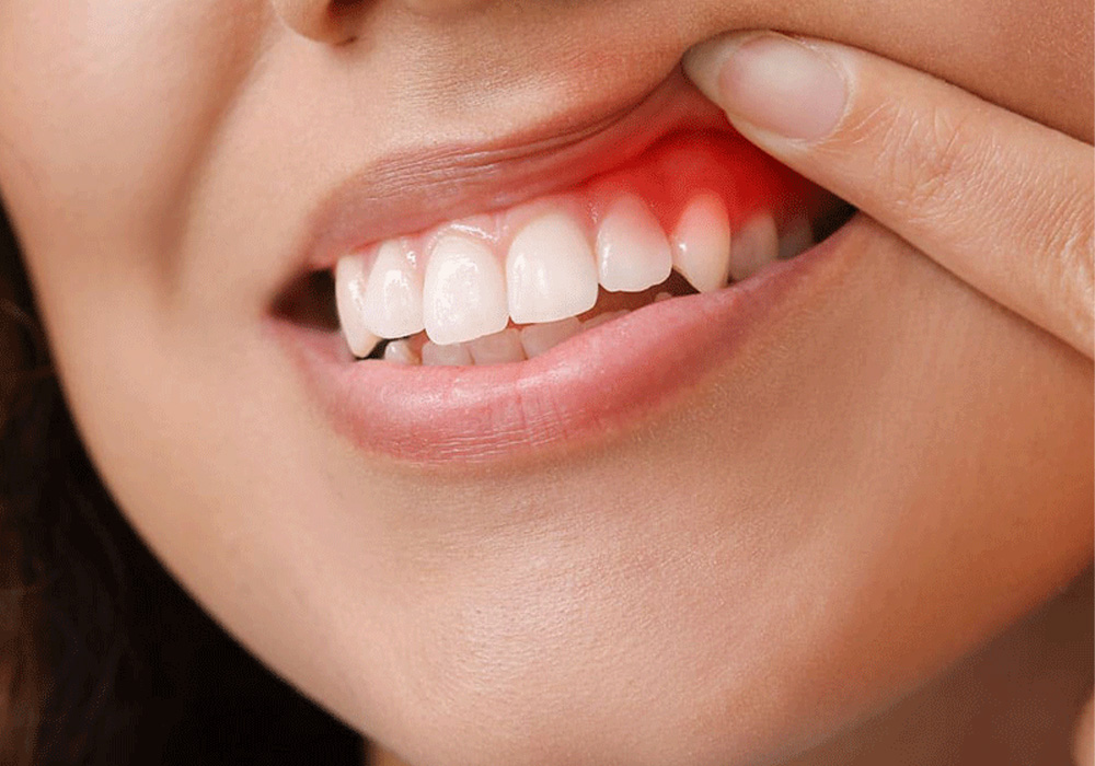 What is the lifespan of a dental implant